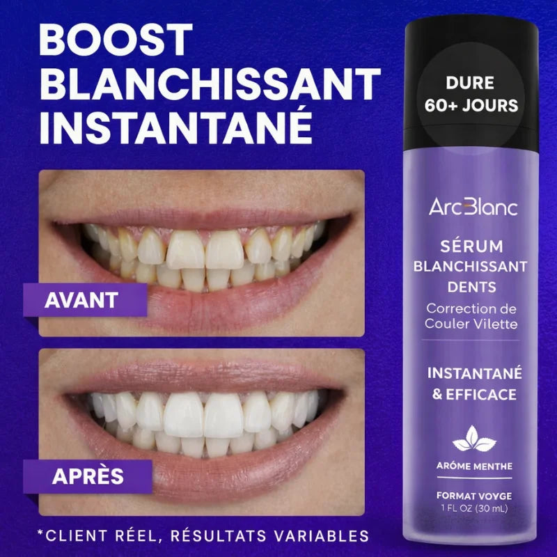 Sérum Violet® I Arc